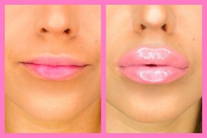 Get fuller lips naturally