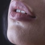 Tips for chapped lips in winters